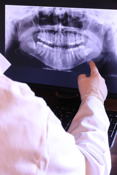Best Emergency Dentist for Knocked-Out Tooth in Anahola, HI